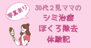 シミ治療・ほくろ除去体験記