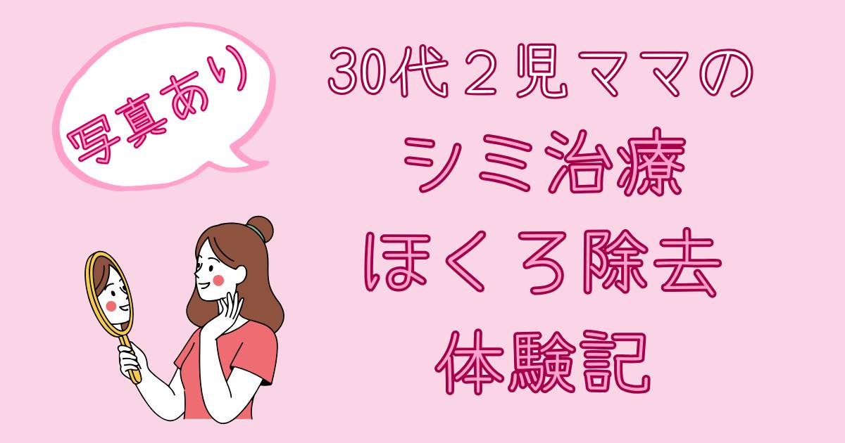 シミ治療・ほくろ除去体験記